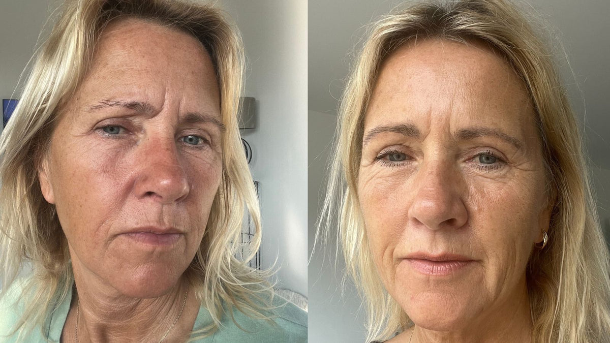Twee portretfoto's van dezelfde vrouw naast elkaar voor en na Apple Peeling