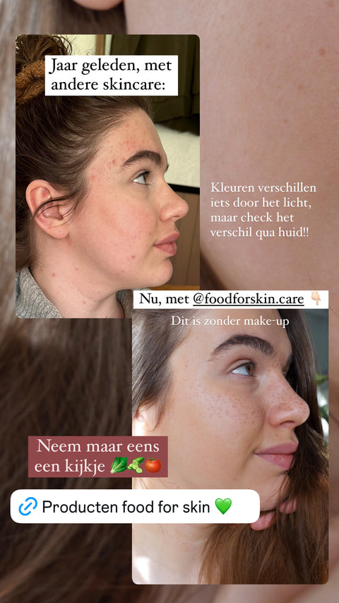 Resultaat Food for Skin bij Renee Jolet
